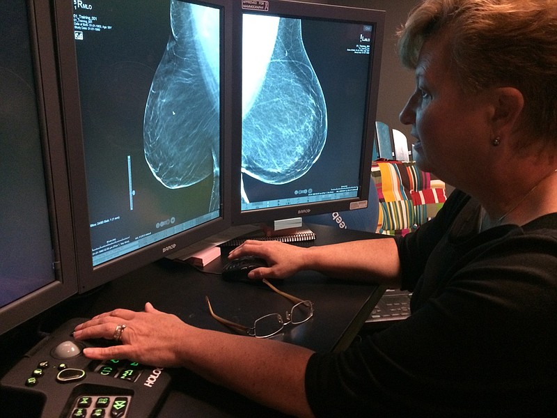 Radiologist Dr. Lanette Varnell explains how breast density levels are detected in a mammogram at the Mary Ellen Locher Breast Center in this 2015 file photo.