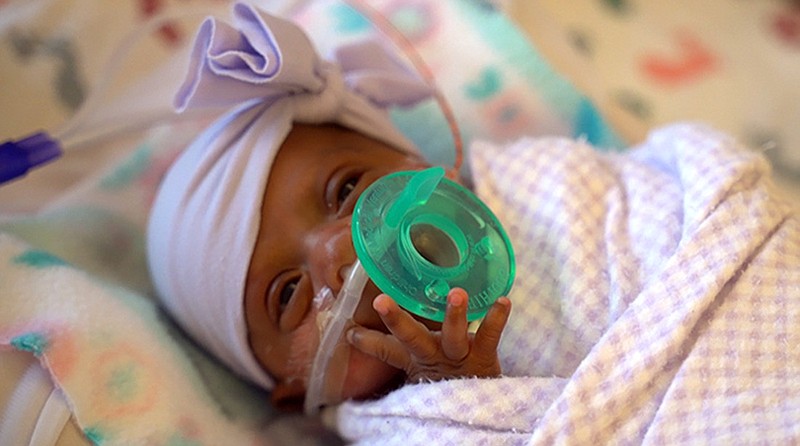 This March, 2019 photo provided by Sharp HealthCare in San Diego shows a baby named Saybie. Sharp Mary Birch Hospital for Women & Newborns said in a statement Wednesday, May 29, 2019, that Saybie, born at 23 weeks and three days, is believed to be the world's tiniest surviving baby, who weighed just 245 grams (about 8.6 ounces) before she was discharged as a healthy infant. She was sent home this month weighing 5 pounds (2 kilograms) after nearly five months in the hospital's neonatal intensive care unit. (Sharp HealthCare via AP