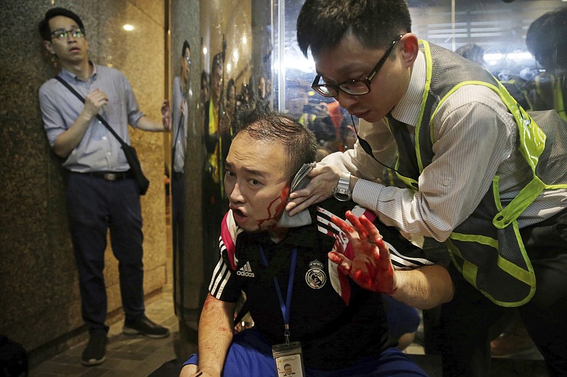 District councilor Andrew Chiu receives medical treatment in Hong Kong, on Sunday, Nov. 3, 2019. Riot police stormed several malls in Hong Kong on Sunday in a move to thwart more pro-democracy protests, though violence did break out when a knife-wielding man slashed several people and bit off part of the ear of a local pro-democracy politician. (Elson Li/HK01 via AP)

