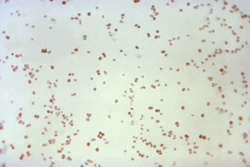 This 1971 microscope image made available by the Centers for Disease Control and Prevention shows Neisseria gonorrhoeae bacteria, which causes the sexually transmitted disease gonorrhea. In a report released Wednesday, Nov. 13, 2019, the Centers for Disease Control and Prevention estimated about 36,000 Americans died from drug-resistant infections in 2017 _ down about 18% from an estimated 44,000 in 2013. Though deaths may be going down, non-fatal infections increased nationally from 2013 to 2017, from 2.6 million to 2.8 million. Dramatic increases in drug-resistant gonorrhea, urinary tract infections, and group A strep were largely to blame. (CDC via AP)