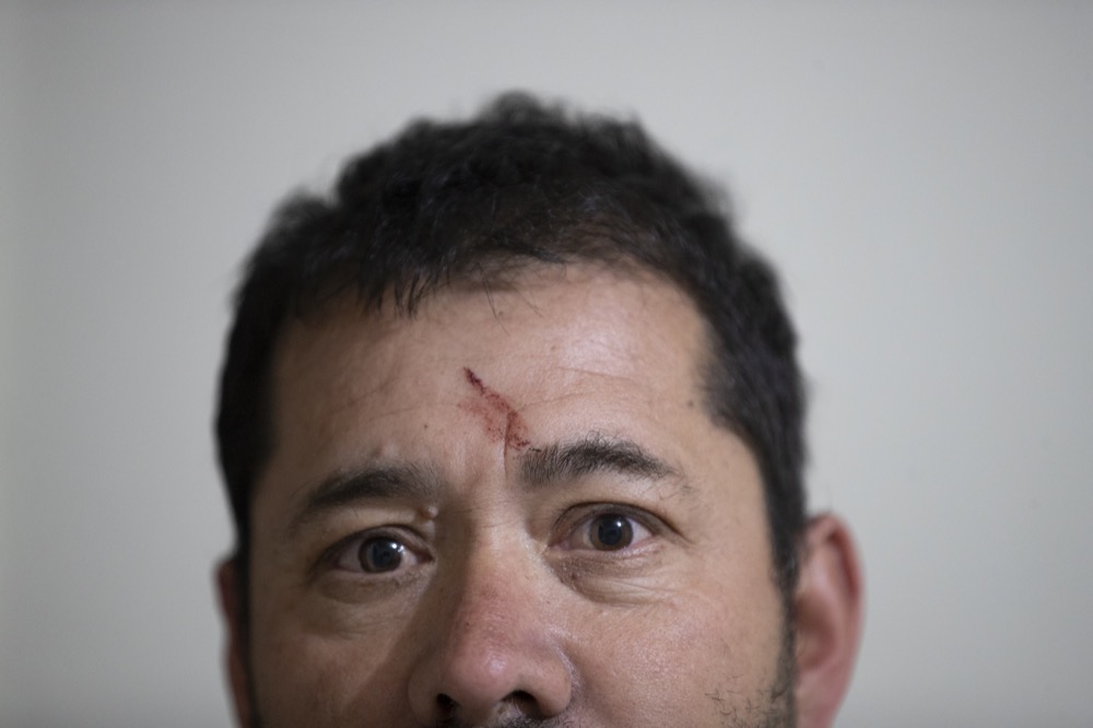Simon Valeriano Raudales, a west Houston resident, is injured after a massive explosion blew the window in the room he was staying at on Friday, Jan. 24, 2020, in Houston. A massive explosion early Friday leveled a warehouse in Houston and damaged nearby buildings and homes, rousing frightened people from their sleep miles away.  (Marie D. De Jesús/Houston Chronicle via AP)