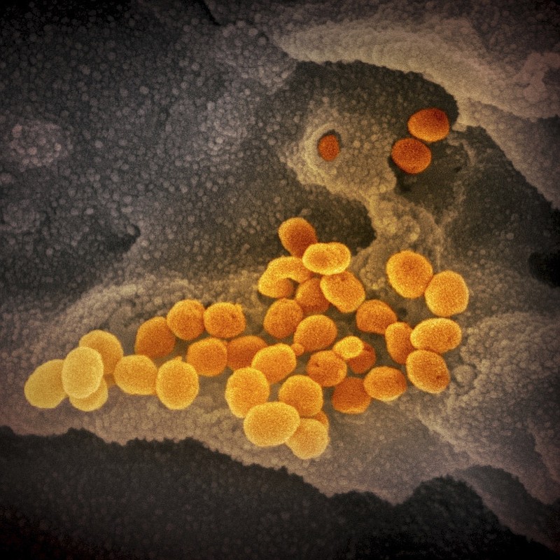 This undated electron microscope image made available by the U.S. National Institutes of Health in February 2020 shows the Novel Coronavirus SARS-CoV-2, orange, emerging from the surface of cells, gray, cultured in the lab. Also known as 2019-nCoV, the virus causes COVID-19. The sample was isolated from a patient in the U.S. (NIAID-RML via AP)


