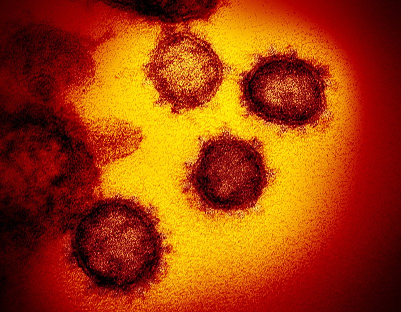 FILE - This undated electron microscope image made available by the U.S. National Institutes of Health in February 2020 shows the Novel Coronavirus SARS-CoV-2. Also known as 2019-nCoV, the virus causes COVID-19. The sample was isolated from a patient in the U.S. On Tuesday, April 21, 2020, U.S. health regulators OK'd the first coronavirus test that allows people to collect their own sample at home, a new approach that could help expand testing options in most states. The sample will still have to be shipped for processing back to LabCorp, which operates diagnostic labs throughout the U.S. (NIAID-RML via AP)


