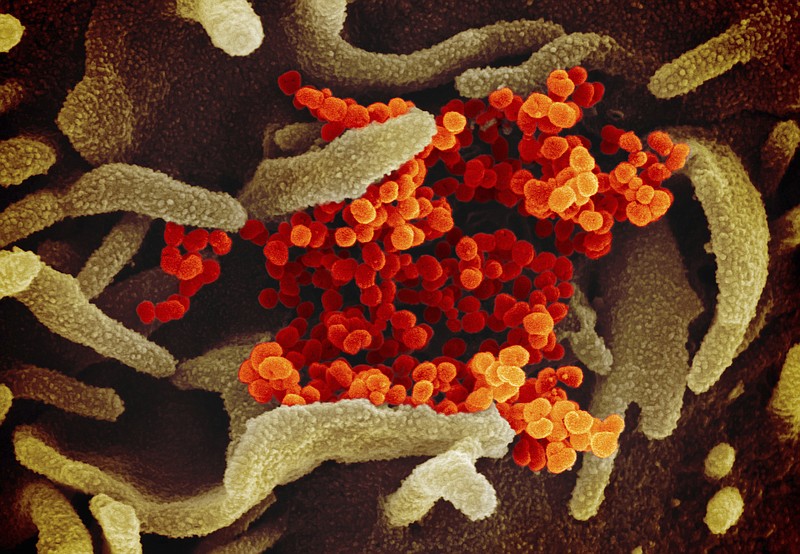 This undated electron microscope image made available by the U.S. National Institutes of Health in February 2020 shows the Novel Coronavirus SARS-CoV-2, orange, emerging from the surface of cells, green, cultured in the lab. Also known as 2019-nCoV, the virus causes COVID-19. The sample was isolated from a patient in the U.S. (NIAID-RML via AP)