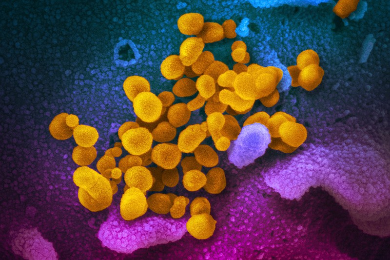 This undated electron microscope image made available by the U.S. National Institutes of Health in February 2020 shows the Novel Coronavirus SARS-CoV-2, yellow, emerging from the surface of cells, blue/pink, cultured in the lab. Also known as 2019-nCoV, the virus causes COVID-19. The sample was isolated from a patient in the U.S. According to a poll from The Associated Press-NORC Center for Public Affairs Research released on Thursday, Feb. 20, 2020, a wide share of Americans are at least moderately confident in U.S. health officials’ ability to handle emerging viruses, and more express concern about catching the flu than catching the new coronavirus. (NIAID-RML via AP)