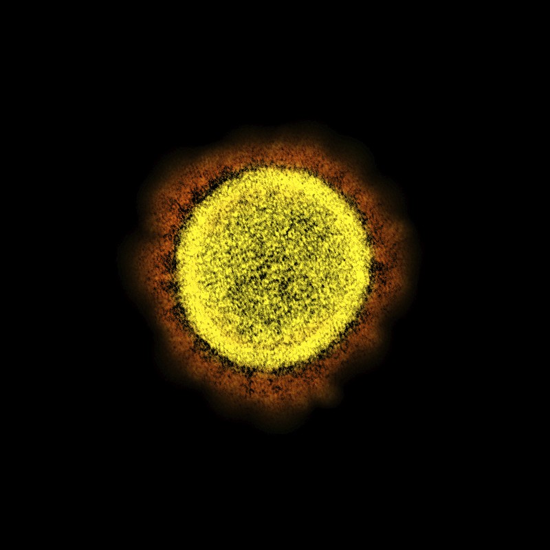 This 2020 electron micrsocope image made available by the National Institute of Allergy and Infectious Diseases shows a Novel Coronavirus SARS-CoV-2 particle isolated from a patient, in a laboratory in Fort Detrick, Md. Coronaviruses, including the newest one, are named for the spikes that cover their outer surface like a crown, or corona in Latin. Using those club-shaped spikes, the virus latches on to the outer wall of a human cell, invades it and replicates, creating viruses to hijack more cells. (NIAID/NIH via AP)


