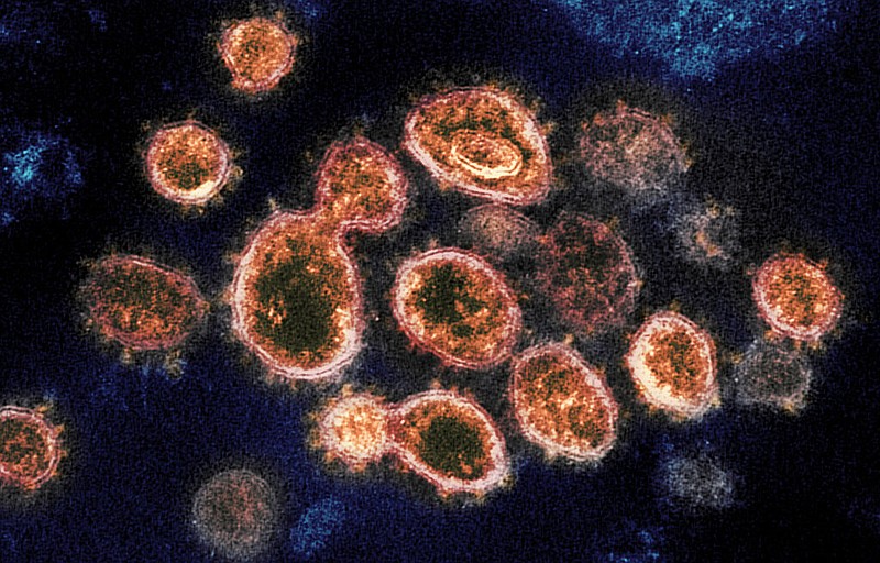 This 2020 electron microscope image provided by the National Institute of Allergy and Infectious Diseases - Rocky Mountain Laboratories shows SARS-CoV-2 virus particles which causes COVID-19. (NIAID-RML via AP)