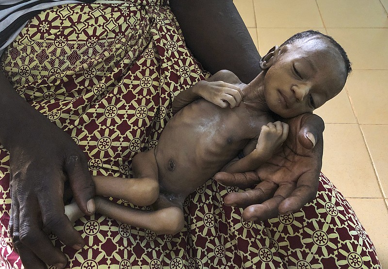 One-month old Haboue Solange Boue, awaiting medical care for severe malnutrition, is held by her mother, Danssanin Lanizou, 30, at the feeding center of the main hospital in the town of Hounde, Tuy Province, in southwestern Burkina Faso on Thursday, June 11, 2020. With the markets closed because of coronavirus restrictions, her family sold fewer vegetables. Lanizou is too malnourished to nurse her. (AP Photo/Sam Mednick)