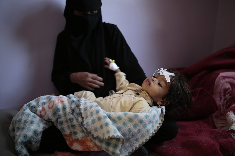 A woman holds her a malnourished boy at a feeding center at Al-Sabeen hospital in Sanaa, Yemen, Tuesday. Nov. 3, 2020. Two-thirds of Yemen's population of about 28 million people are hungry, and nearly 1.5 million families currently rely entirely on food aid to survive, with another million people are set to fall into crisis levels of hunger before the year end, according to aid agencies working in Yemen. (AP Photo/Hani Mohammed)