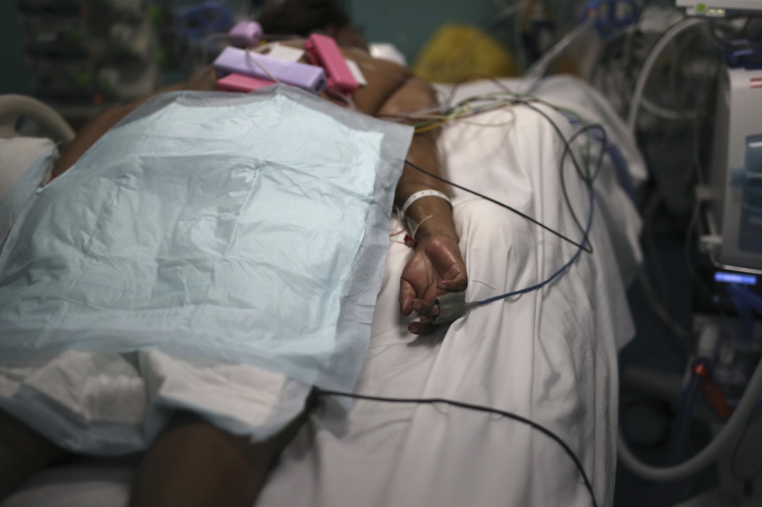 A patient afflicted with COVID-19 lies on a bed in a hospital in Marseille, France, on Sept.10, 2020. (AP Photo/Daniel Cole)