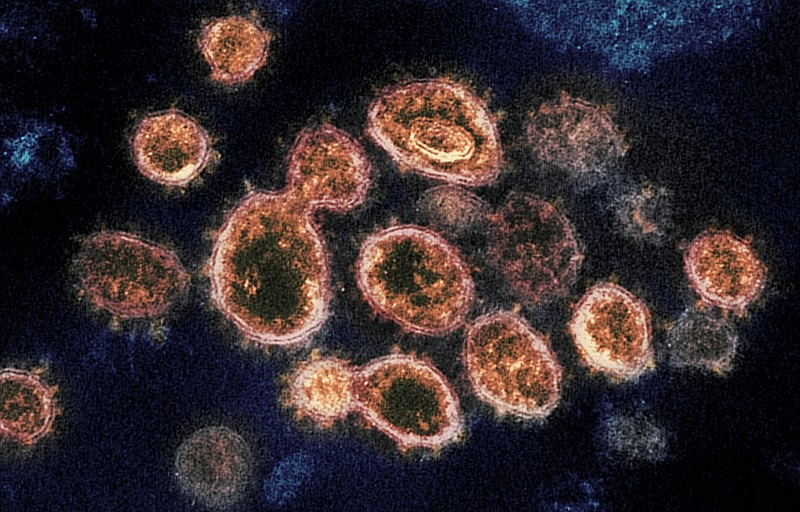 FILE - This 2020 electron microscope image provided by the National Institute of Allergy and Infectious Diseases - Rocky Mountain Laboratories shows SARS-CoV-2 virus particles which cause COVID-19, isolated from a patient in the U.S., emerging from the surface of cells cultured in a lab. Viruses are constantly mutating, with coronavirus variants circulating around the globe. (NIAID-RML via AP)