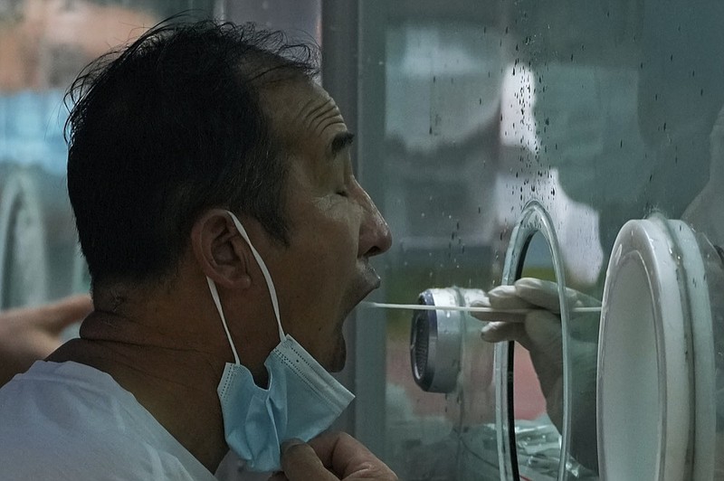 A man pulls his mask to get his routine COVID-19 throat swab at a coronavirus testing site in Beijing, Tuesday, Aug. 9, 2022. (AP Photo/Andy Wong)


